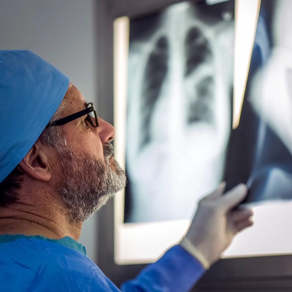 A consultant examining an X-ray